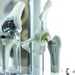 Modern knee and hip prosthesis made by cad engineer and manufactured by 3d printing